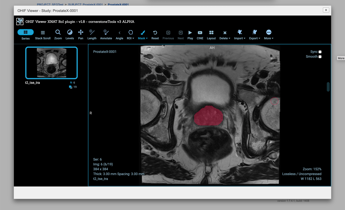 XNAT with OHIF Viewer