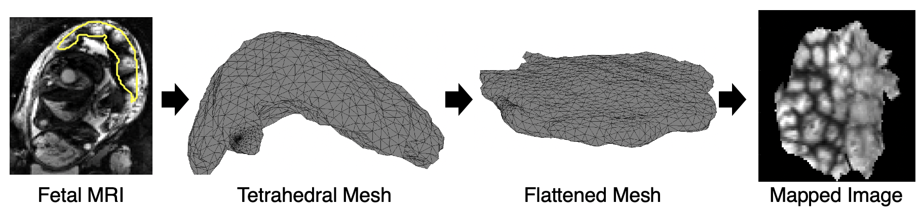 Illustration of flattening